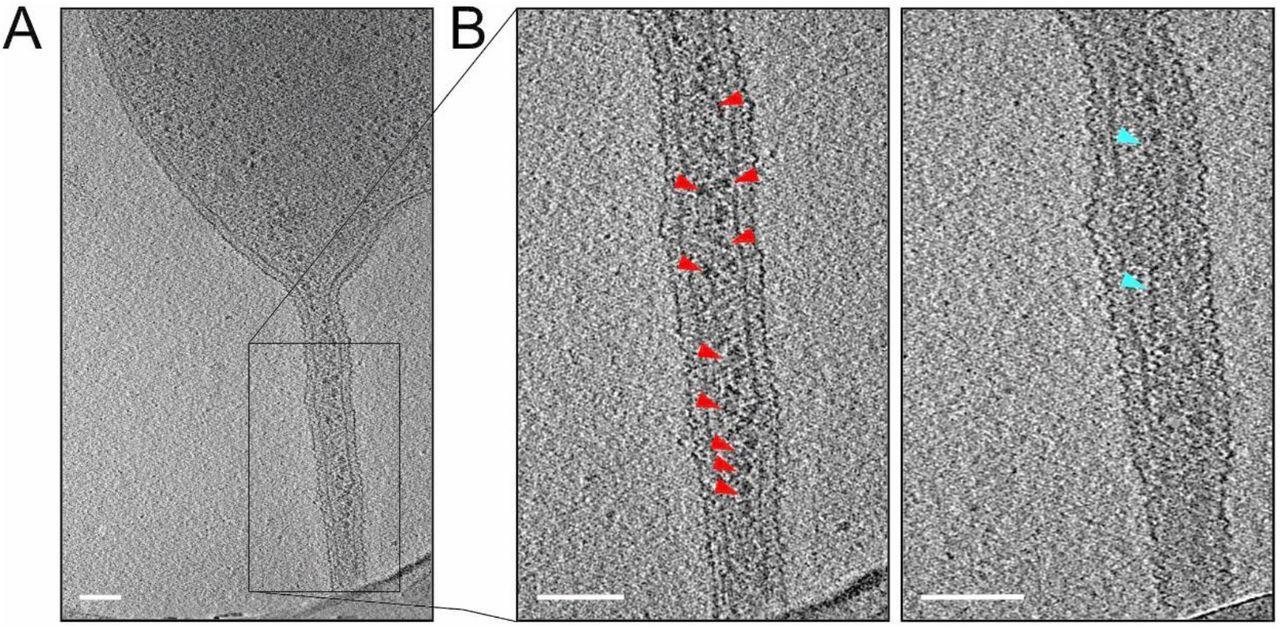 cytoplasmic bridge between Haloferax volcanii cells