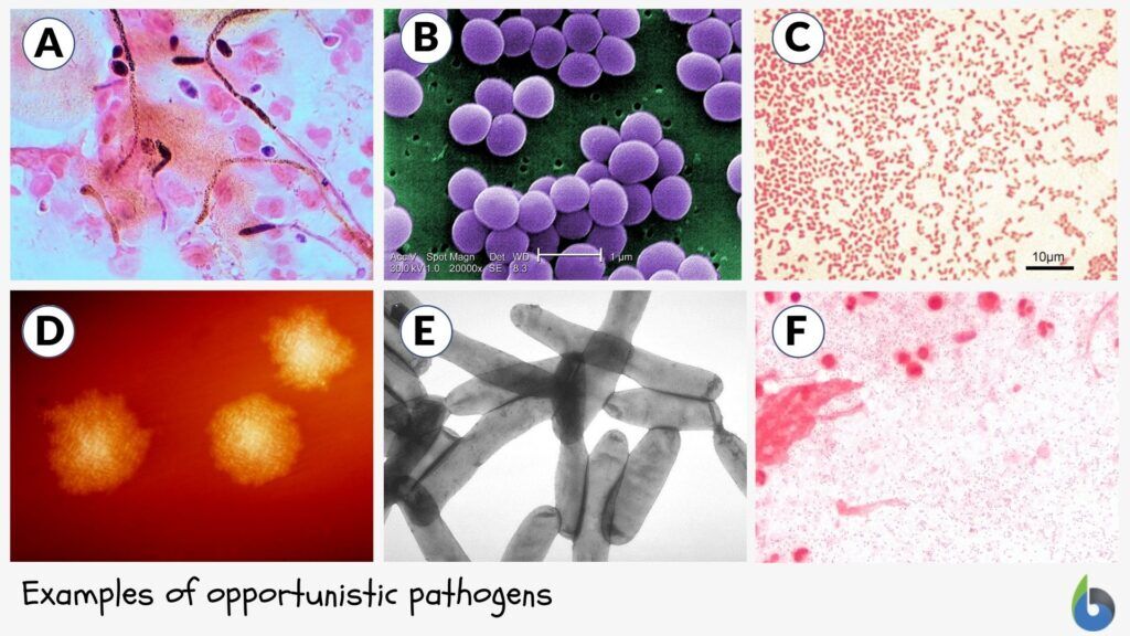 examples of opportunistic pathogens