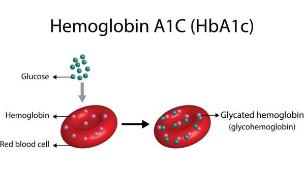 HbA1C test for diabetes