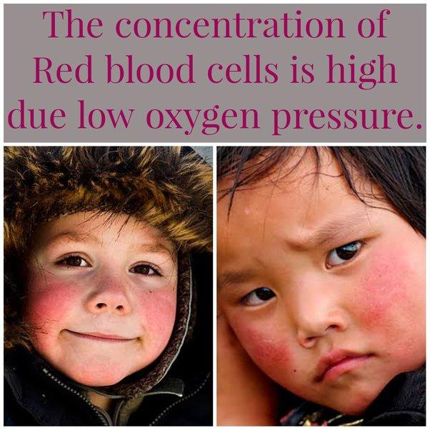 red cheeks of people living in high altitudes