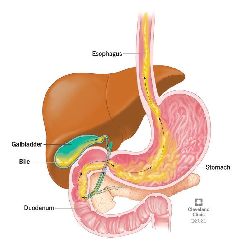 Bile - Definition and Examples - Biology Online Dictionary